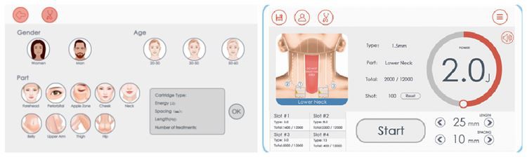 Hifu Ulthera Machine