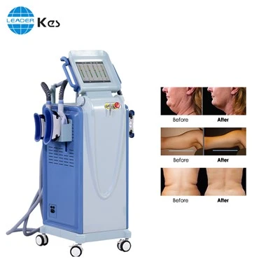 Μηχανή λίπους Cryolipolysis