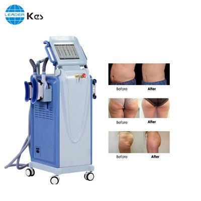 Μηχανή αδυνατίσματος κατεψυγμένης λιπόλυσης